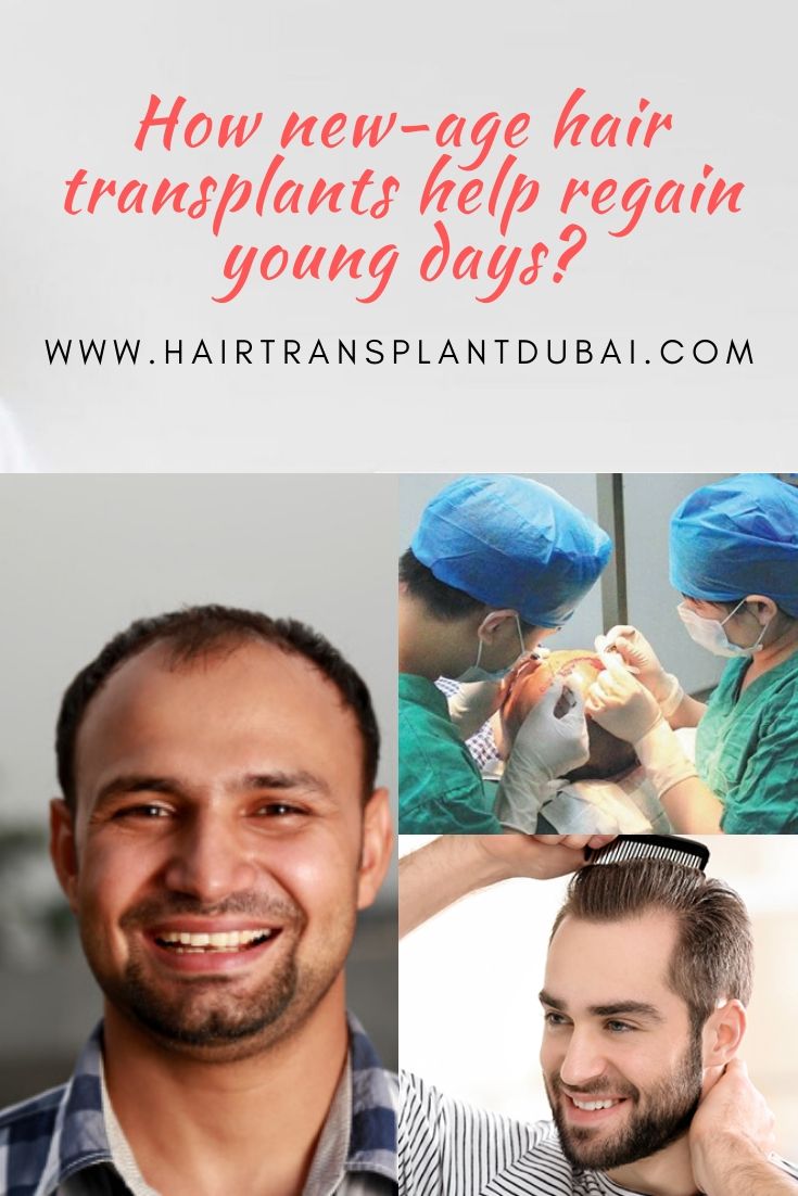 How new age hair transplants help regain young days